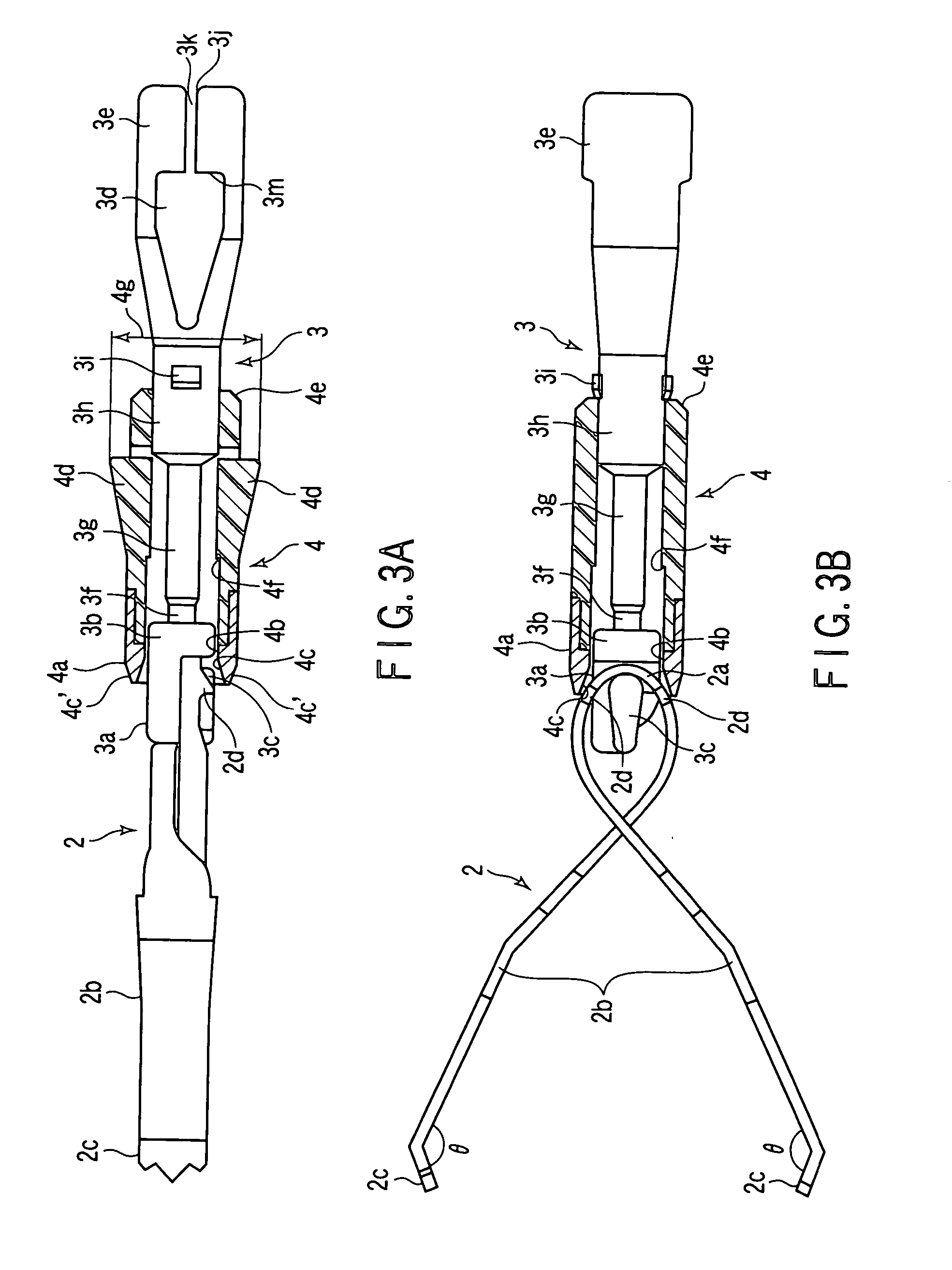 Living tissue ligation device