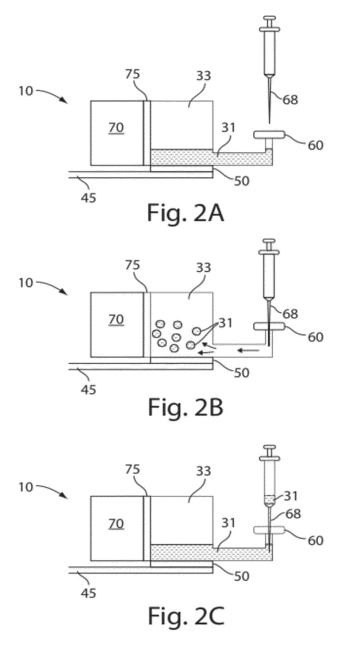 Plasma or serum production and removal of fluids under reduced pressure