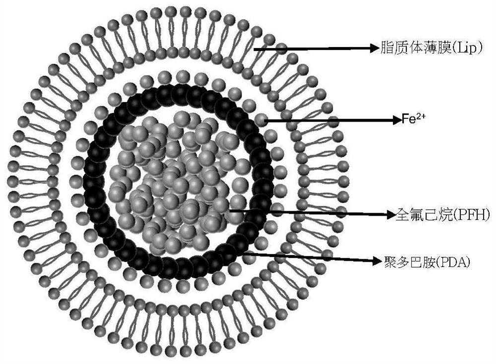 Polydopamine perfluorohexane nanoliposome and preparation method and application thereof