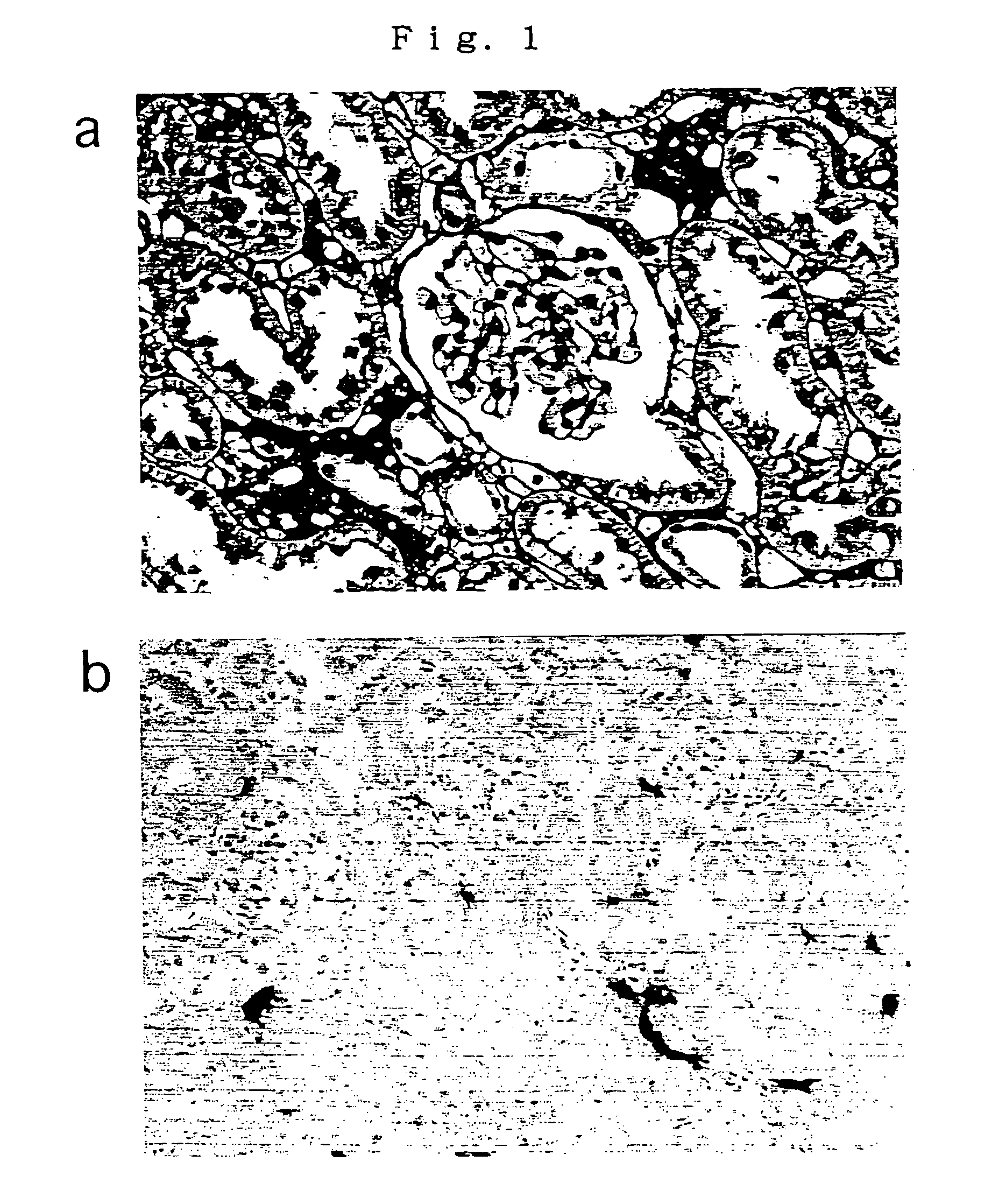 Method of expressing foreign gene in kidney