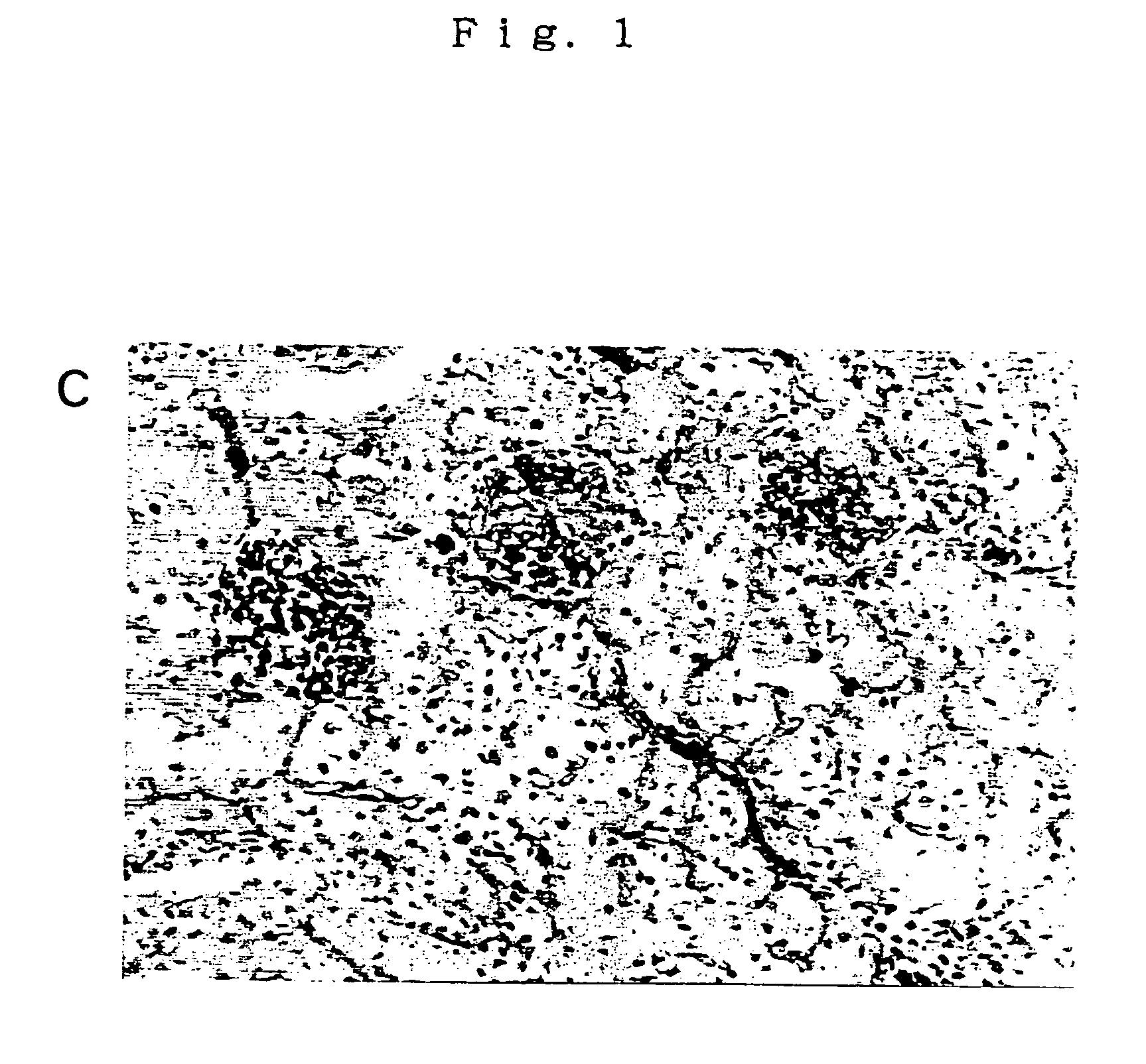 Method of expressing foreign gene in kidney