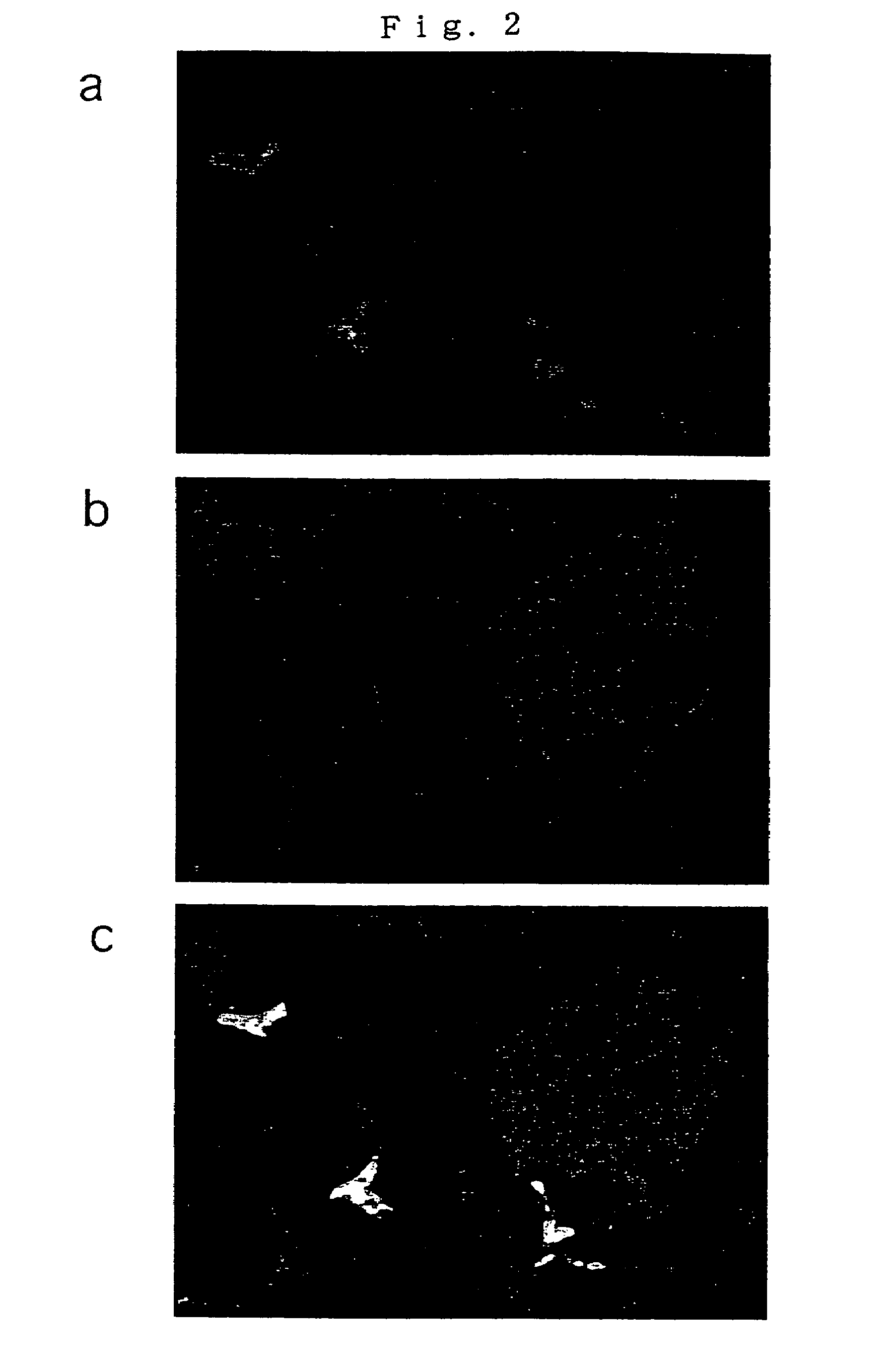 Method of expressing foreign gene in kidney