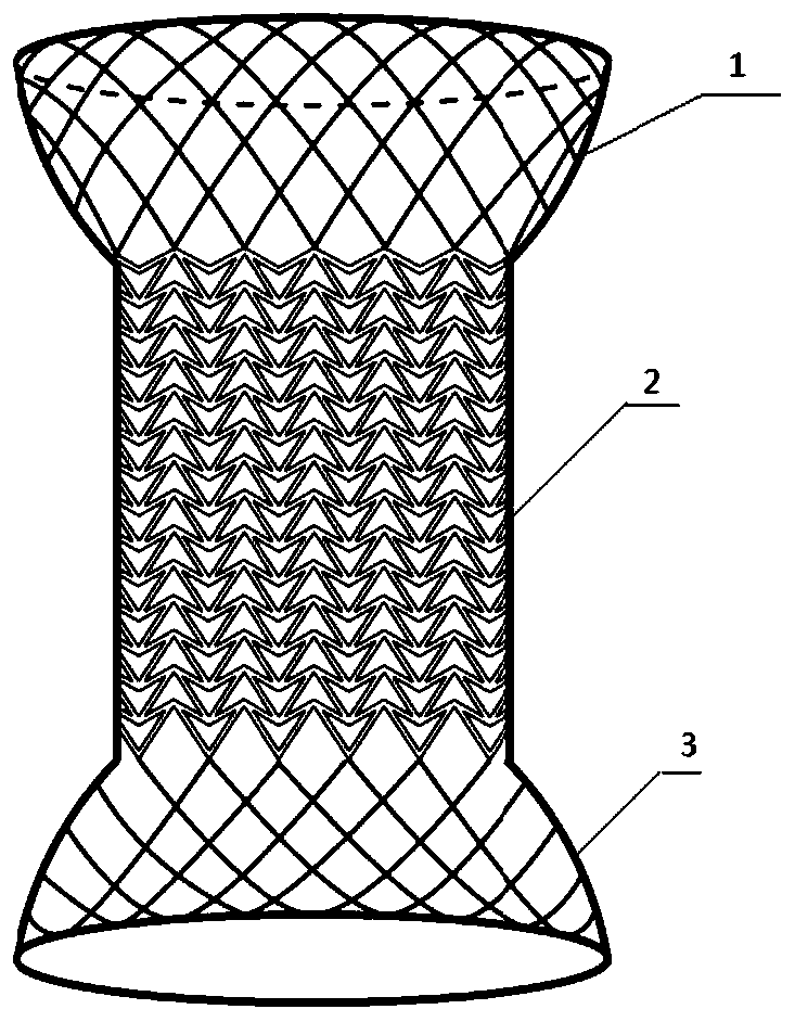 Anti-skid, self-dilating and degradable esophagus stent with negative Poisson's ratio structure and preparation of stent