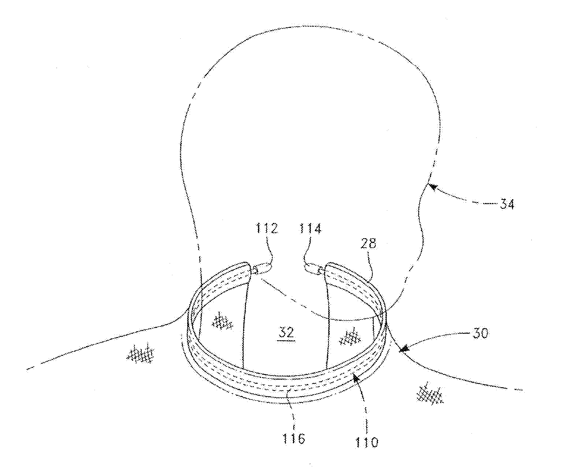 Neck Engaging Hospital Gown and Method of Manufacture