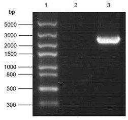 Acyl coenzyme A oxidase 2 gene RKACOX2 and application thereof