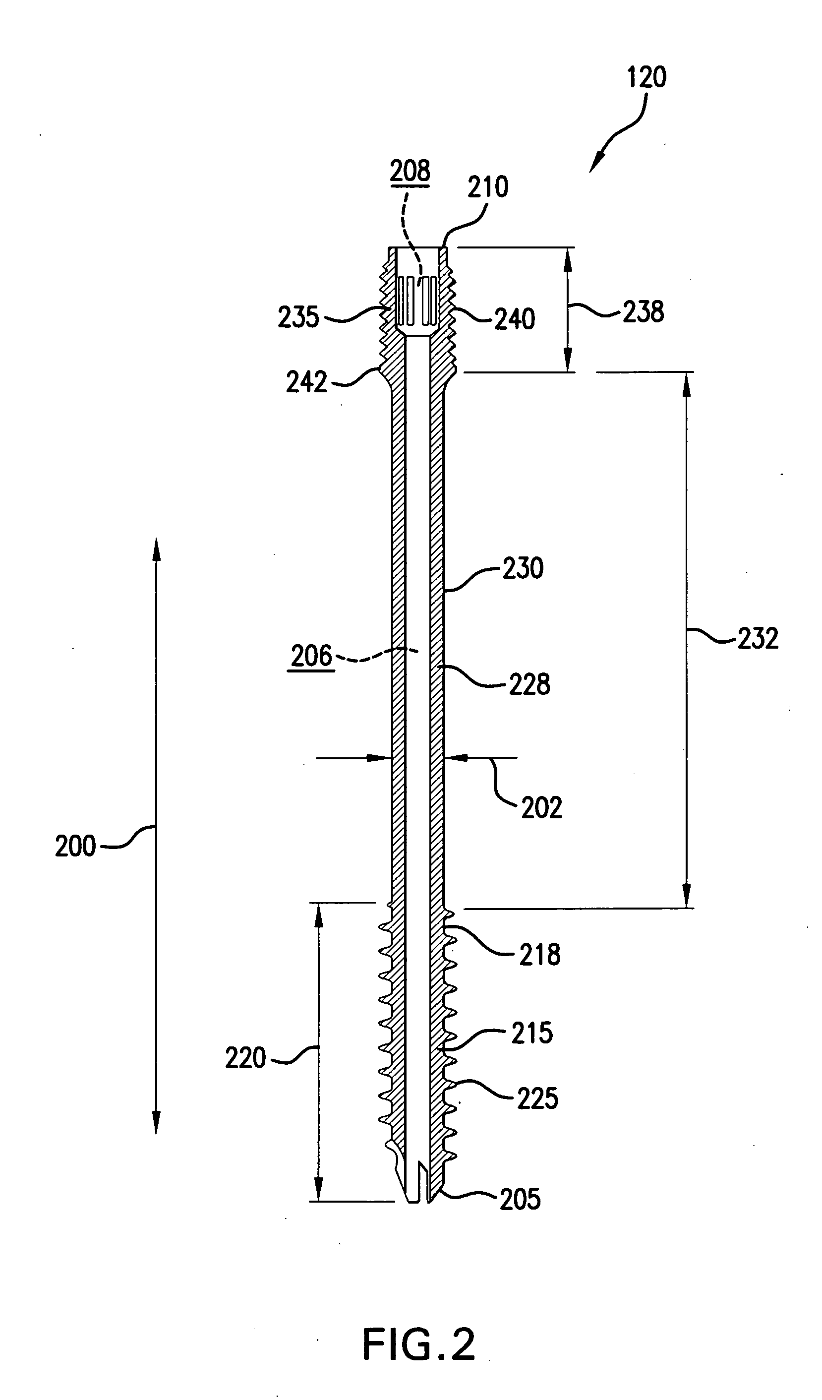 Compression screw assembly, an orthopedic fixation system including a compression screw assembly and method of use