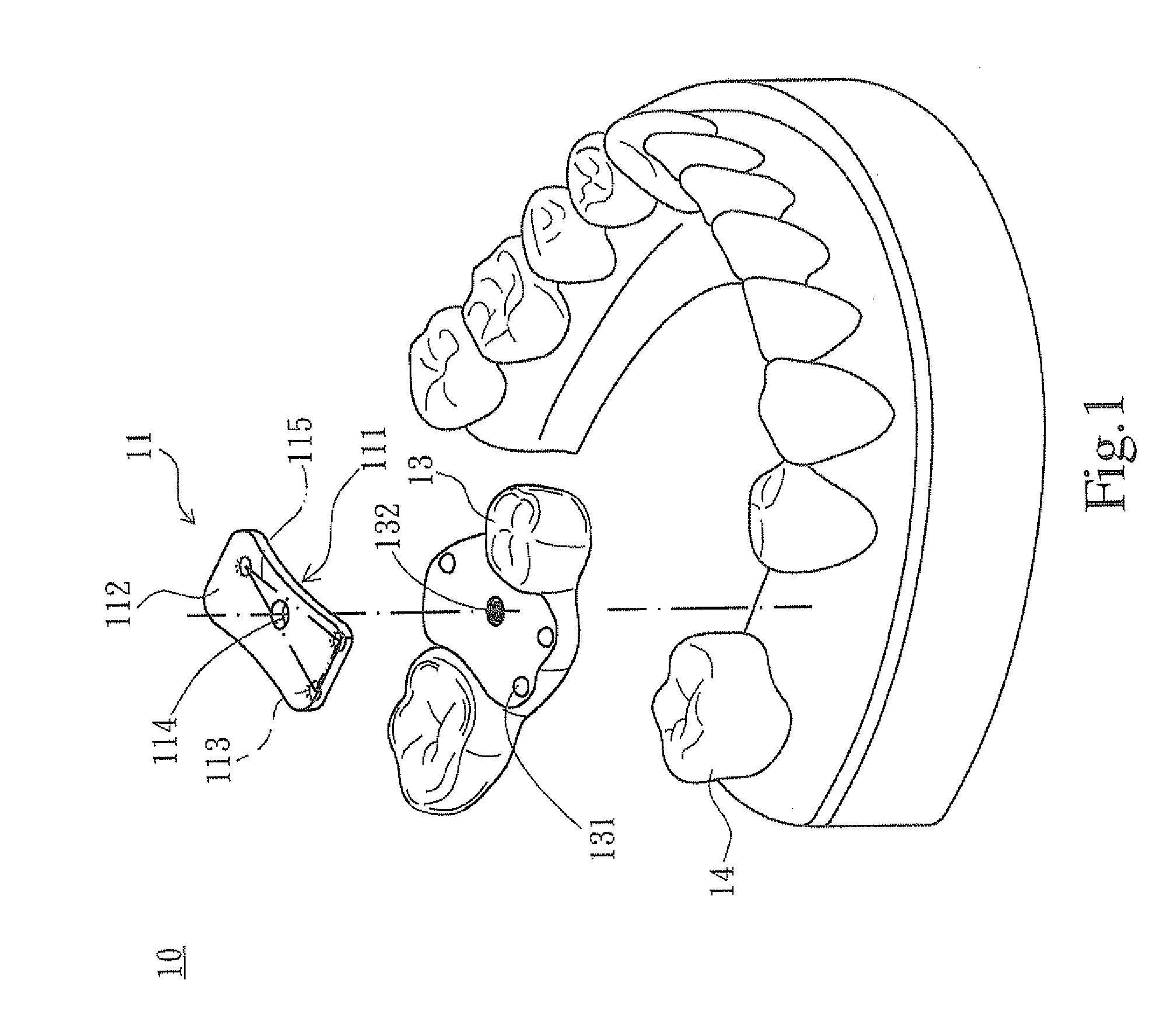 Method of manufacturing surgical template positioning device