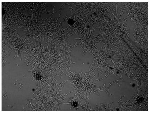 A method for preparing cardiac progenitor cells