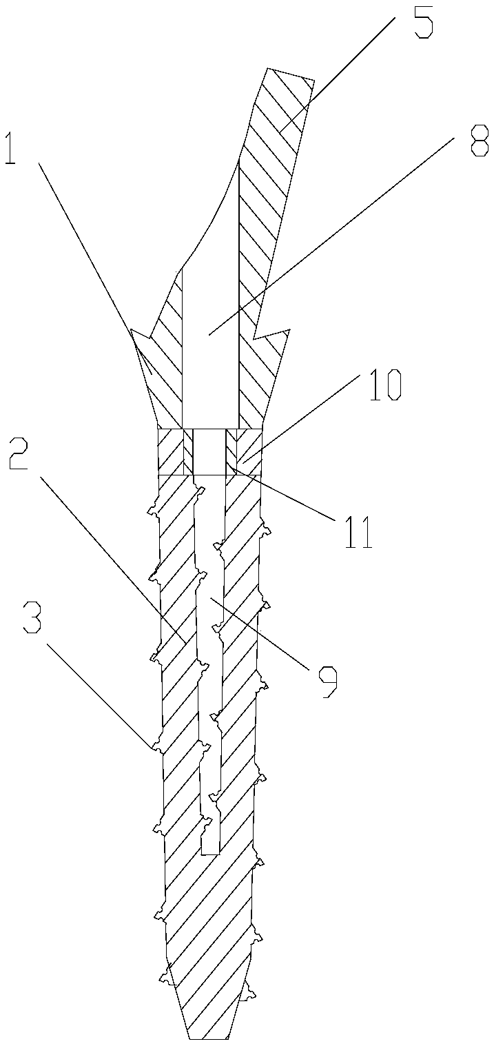 Bone plane root-form dental implant