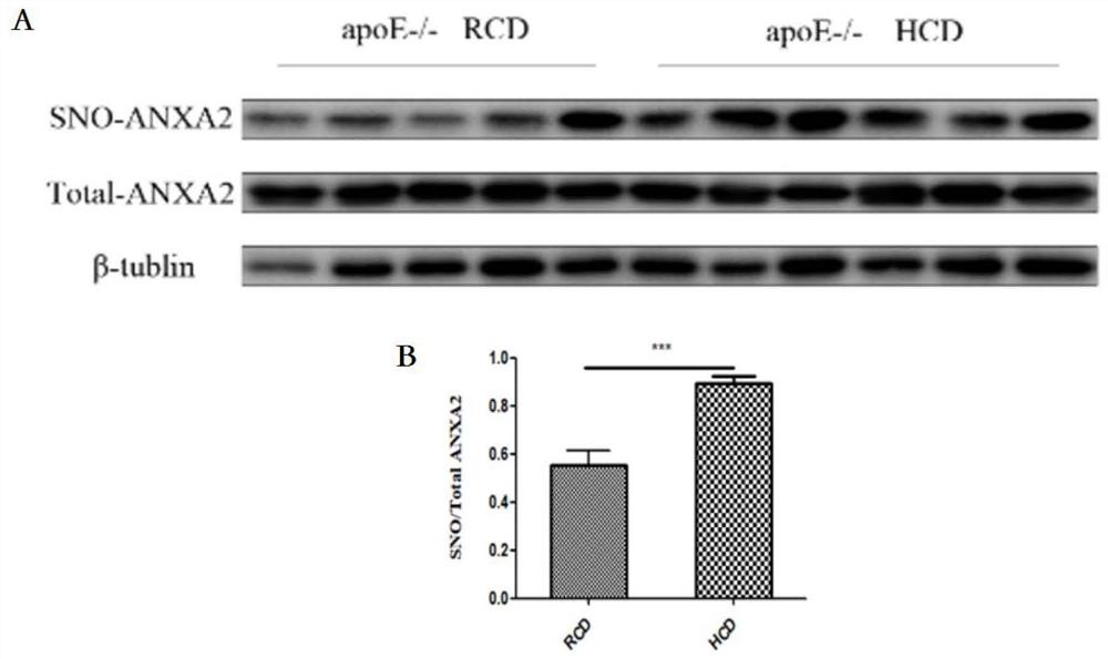 Medicinal application of interfering with annexin a2 sulfhydryl nitrosylation modification