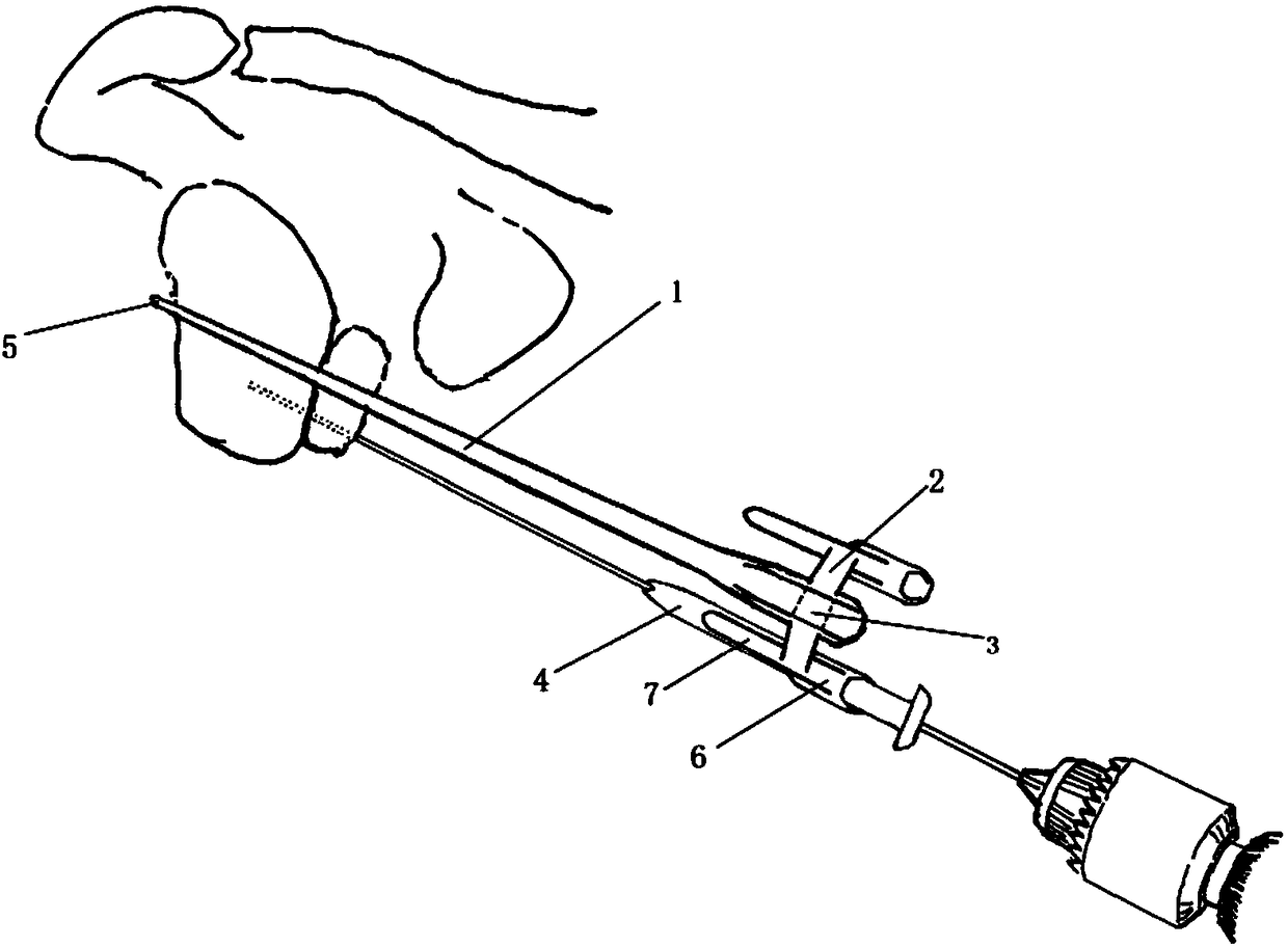 Adjustable surgical positioner