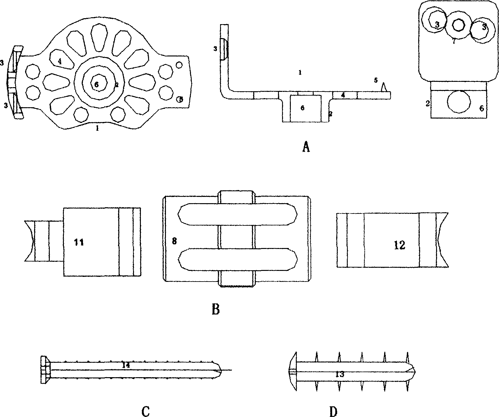 Frame-type artificial vertebral body