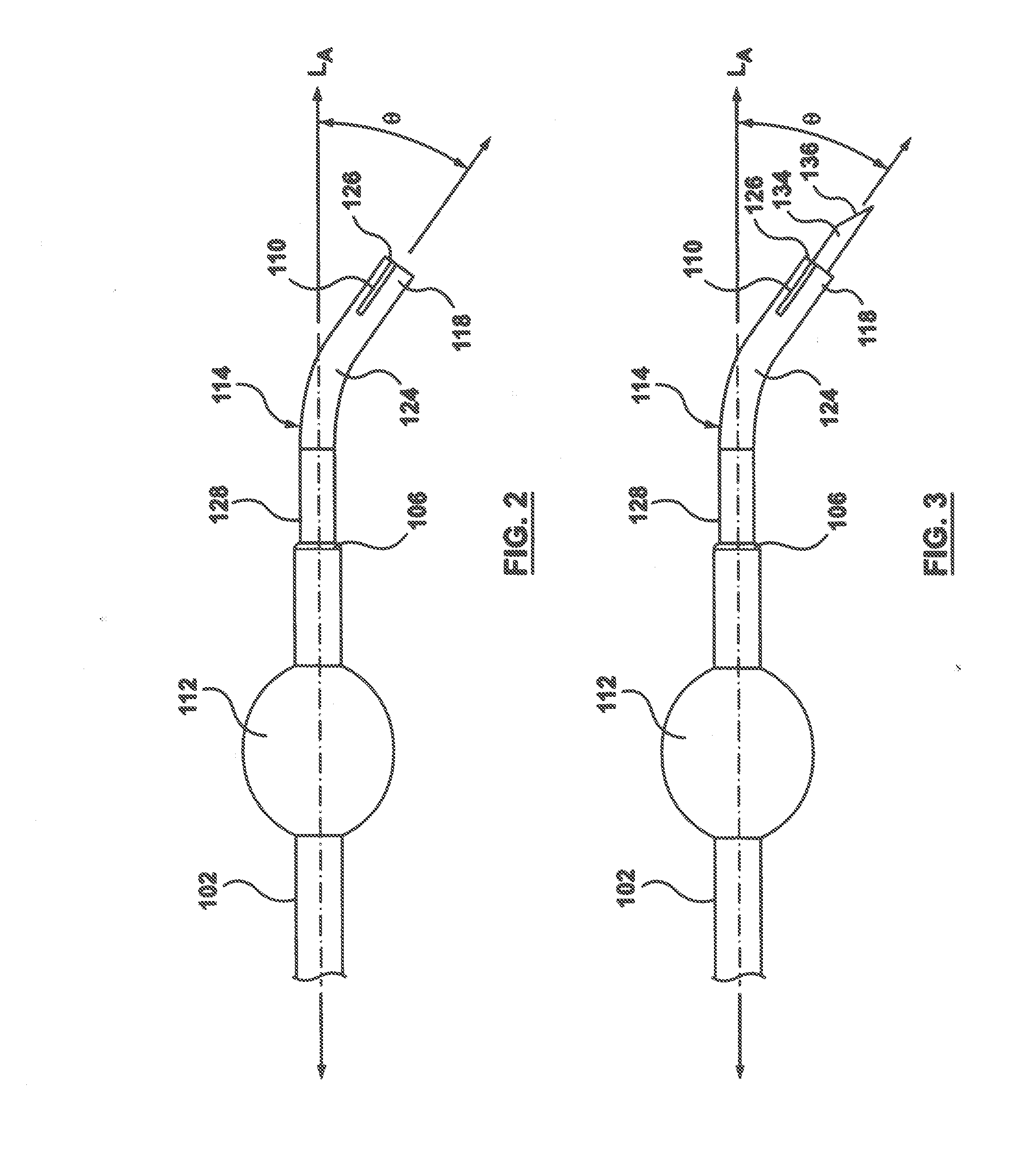 Occlusion Bypassing Apparatuses and Methods for Bypassing an Occlusion in a Blood Vessel