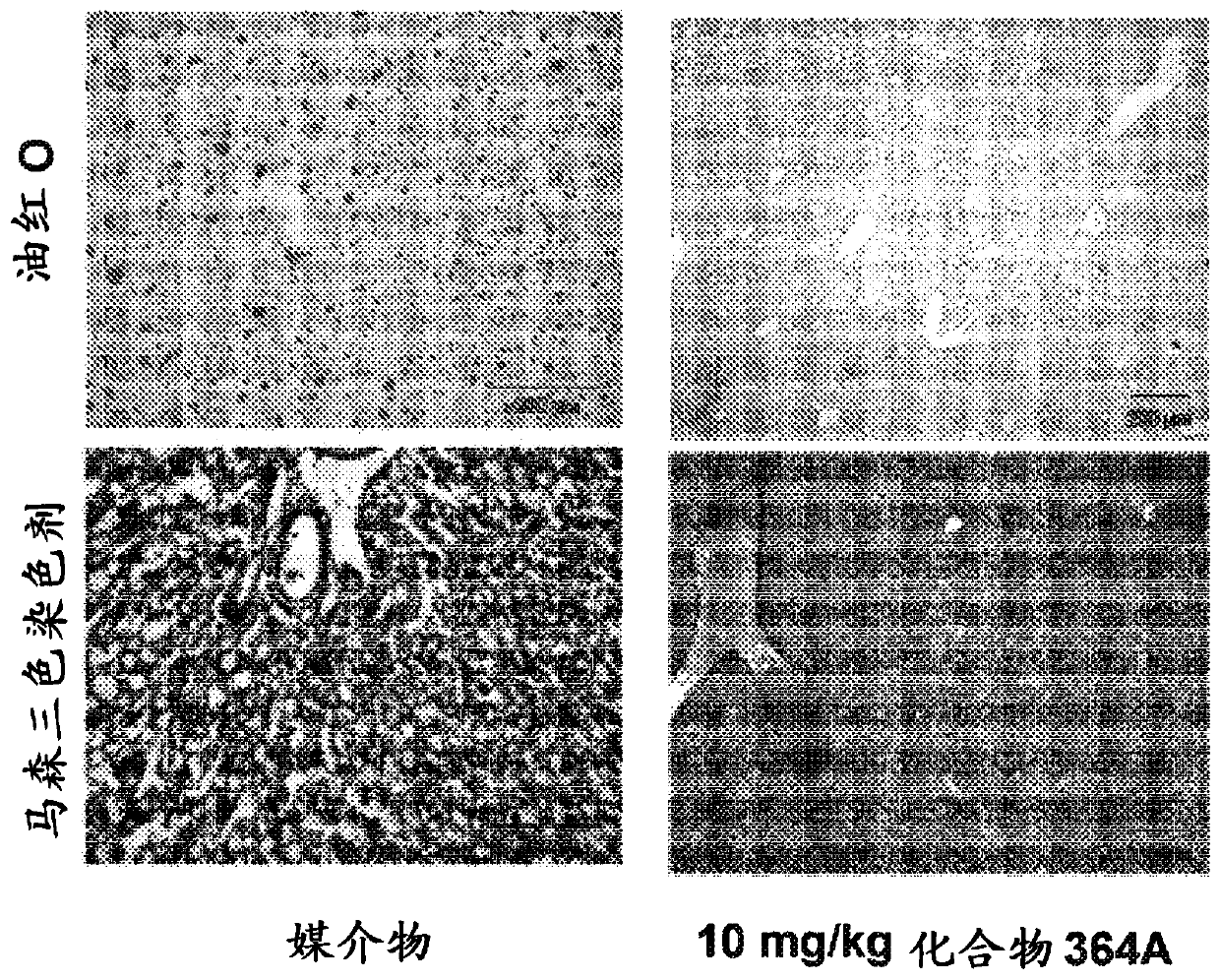 Heterocyclic modulators of lipid synthesis