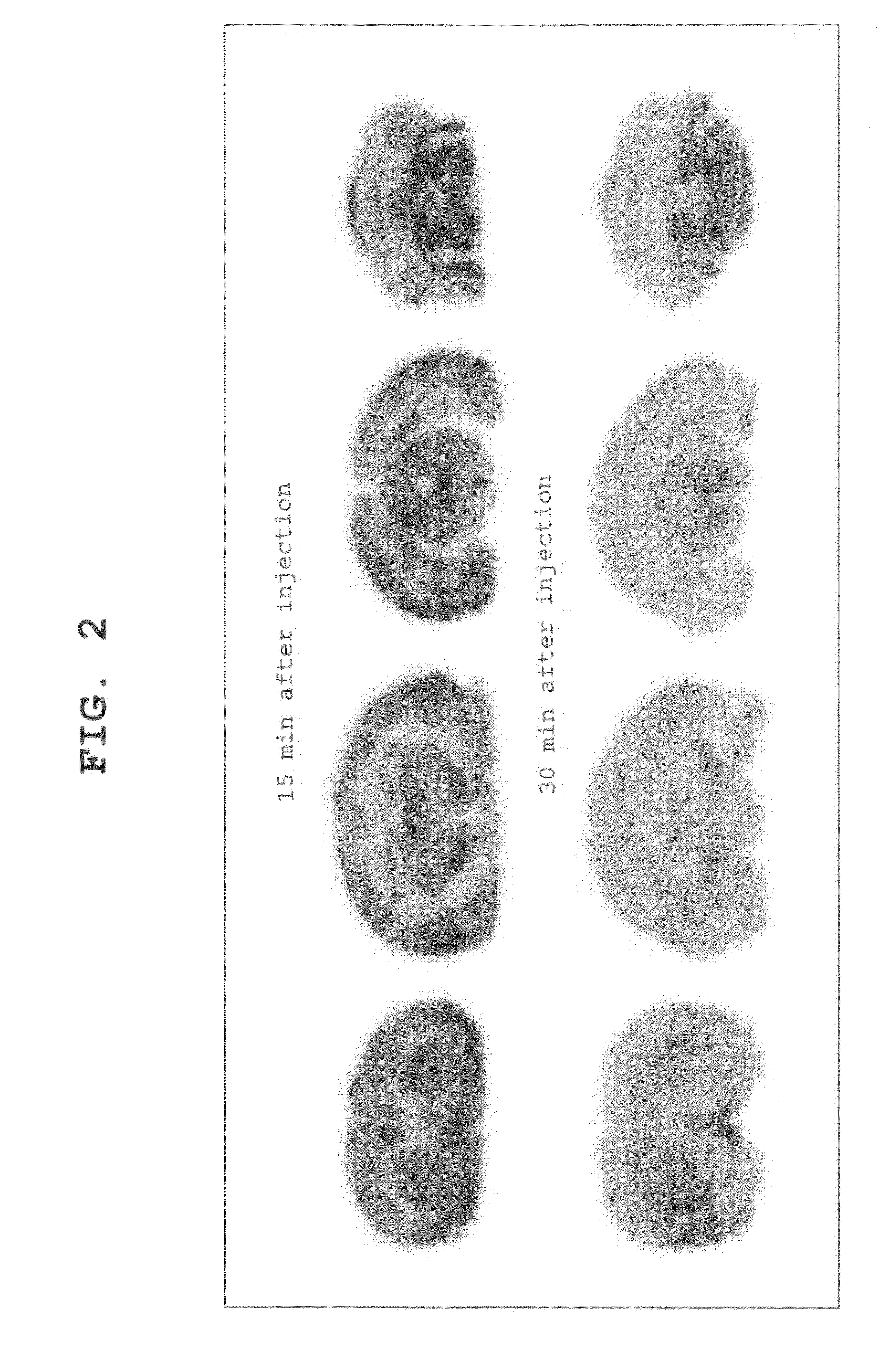 Ligand for Vesicular Acetylcholine Transporter