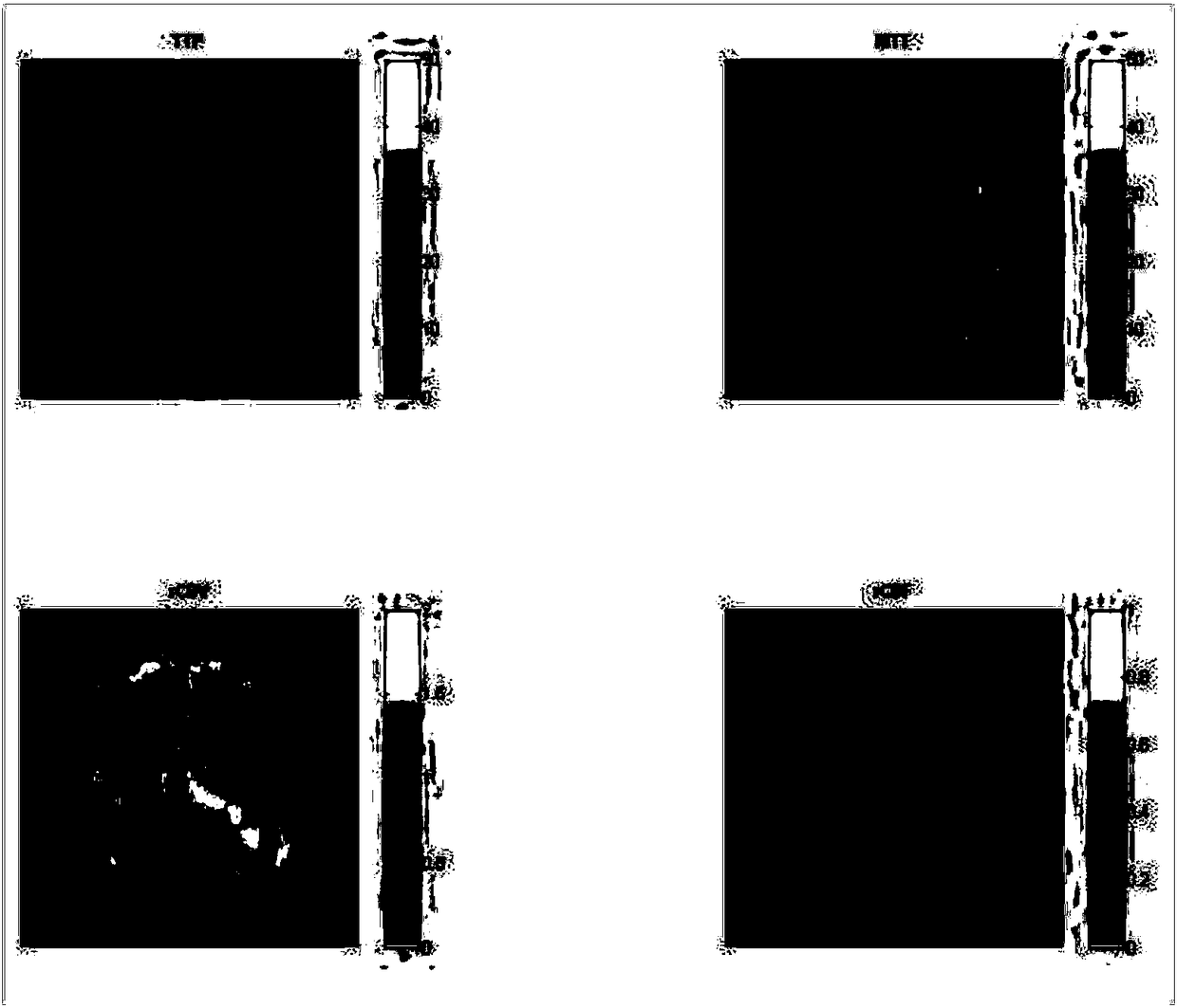 A post-processing method and system for magnetic resonance perfusion imaging