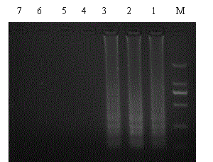 RT-LAMP (Reverse Transcription Loop-Mediated Isothermal Amplification) primer group and kit for detecting avian influenza viruses and applications of RT-LAMP primer group and kit