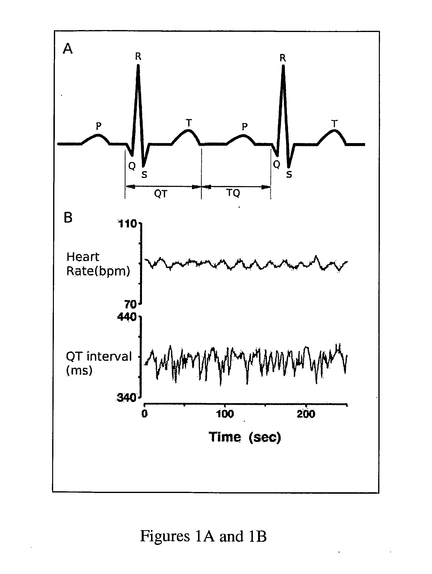 Novel methodology for arrhythmia risk stratification by assessing qt interval instability