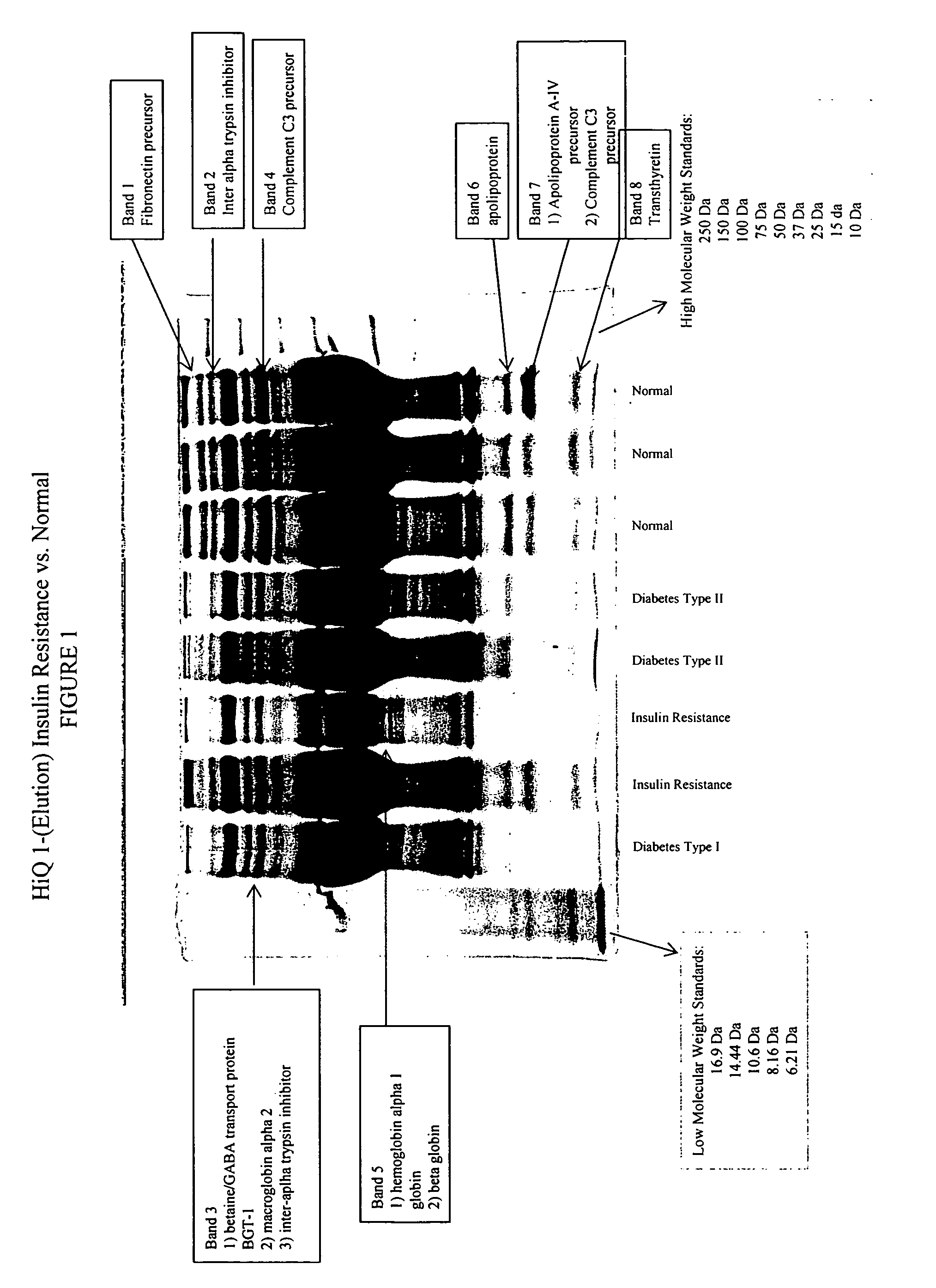 Interalpha trypsin inhibitor biopolymer markers indicative of insulin resistance