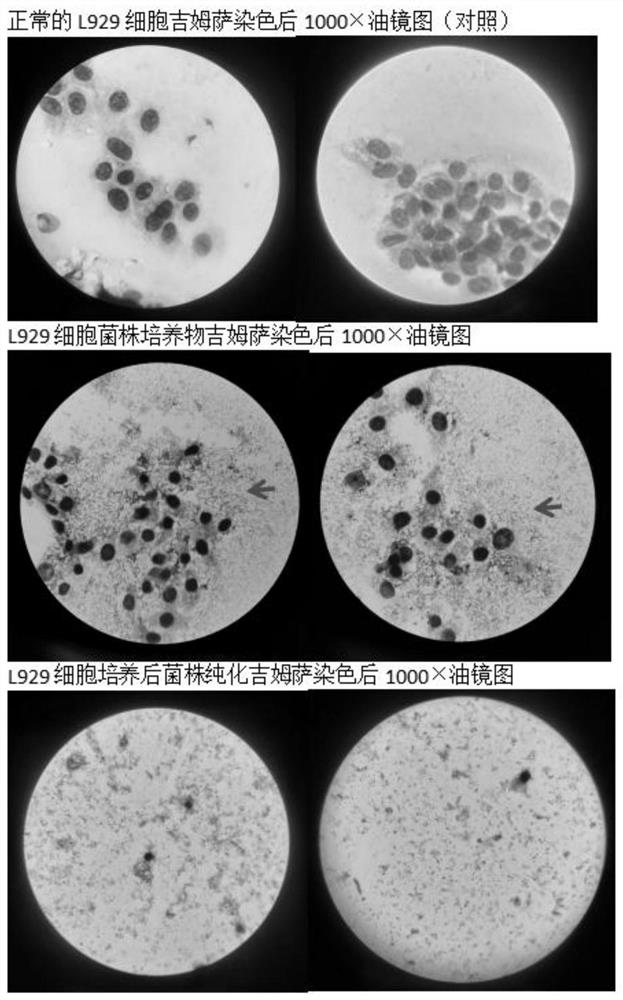 Separation method of rickettsia intracellular bacteria strain