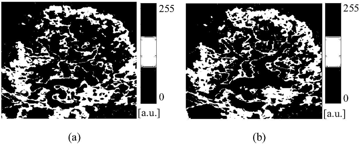 A Respiratory Motion Compensated Ultrasonic Contrast-enhanced Perfusion Parameter Imaging Method