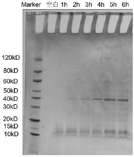 Zearalenone hydrolytic enzyme and coding gene and application thereof