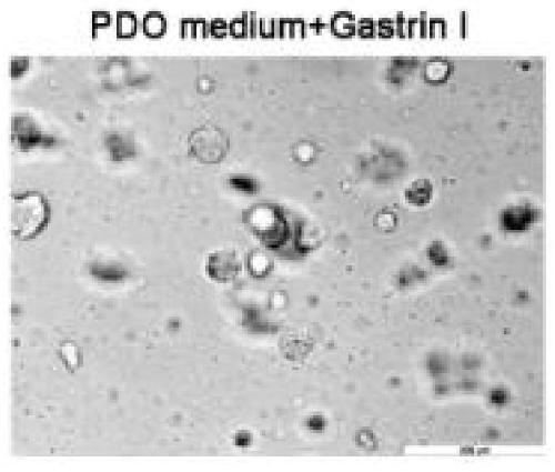 Culture method of 3D tumor organs for test of gastric cancer