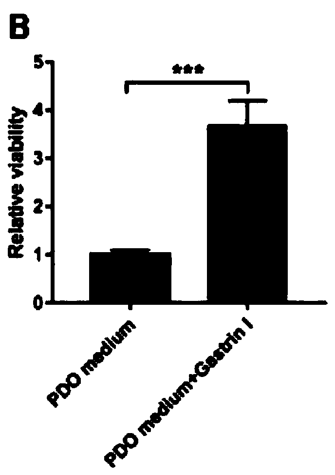 Culture method of 3D tumor organs for test of gastric cancer