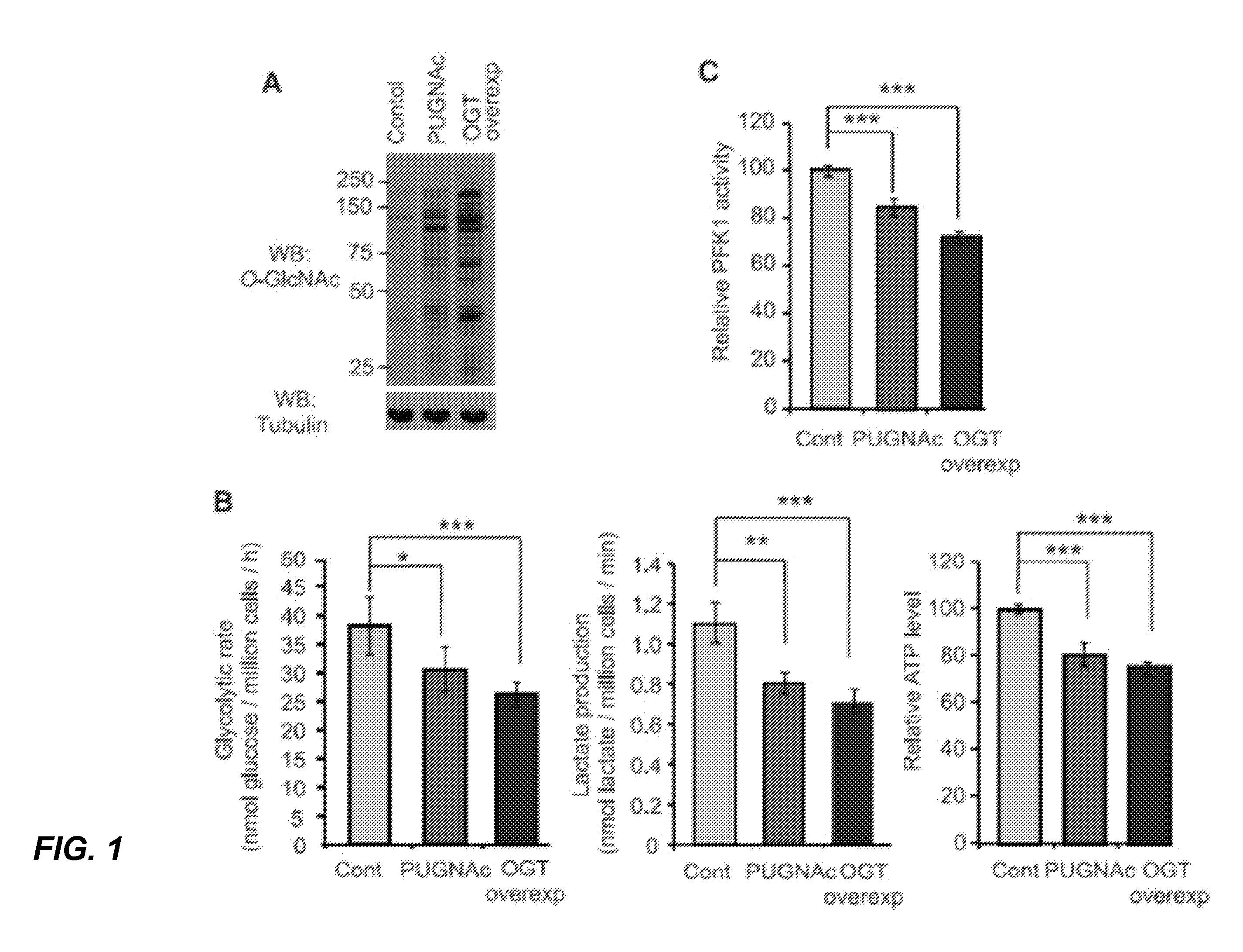 Targeting phosphofructokinase and its glycosylation form for cancer