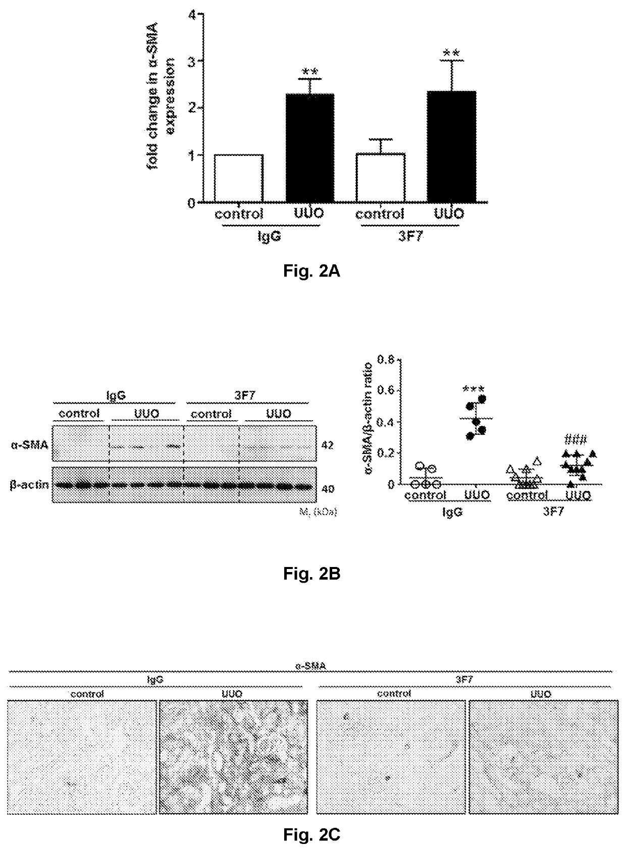 Use of a FXIIa-inhibitor in the treatment of renal fibrosis and/or chronic kidney disease