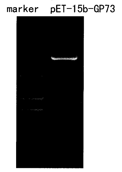 Monoclonal antibody against GP73 protein, preparation method and application thereof