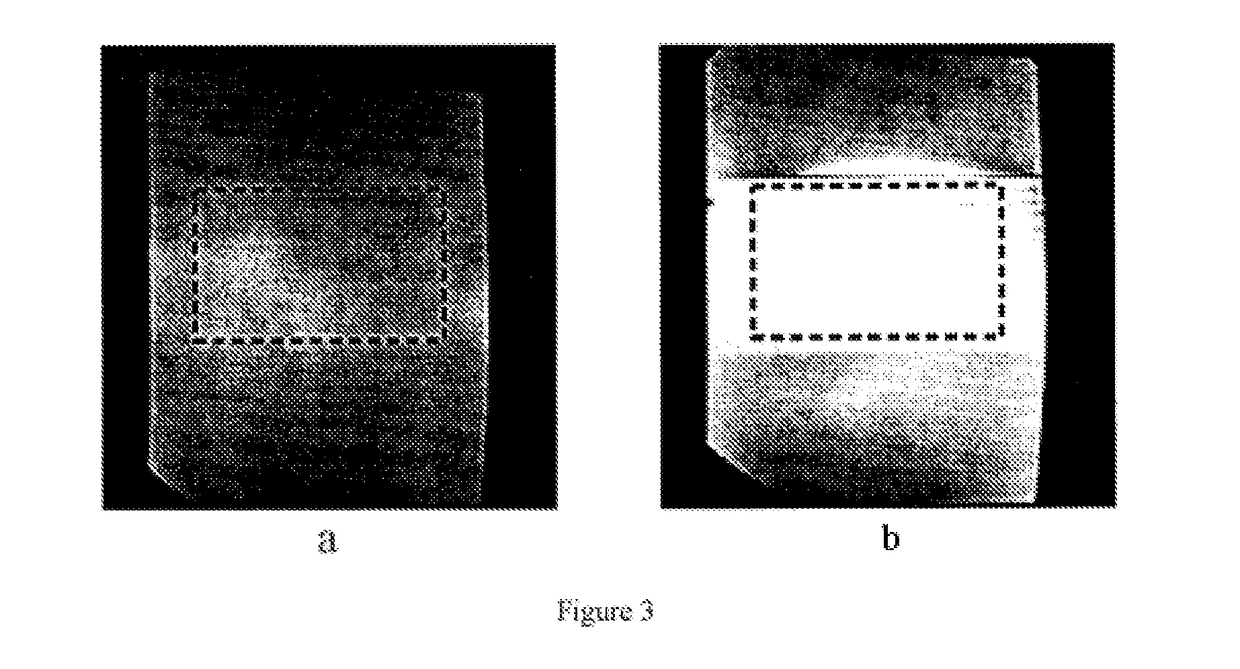 Magnetic Resonance Imaging Machine