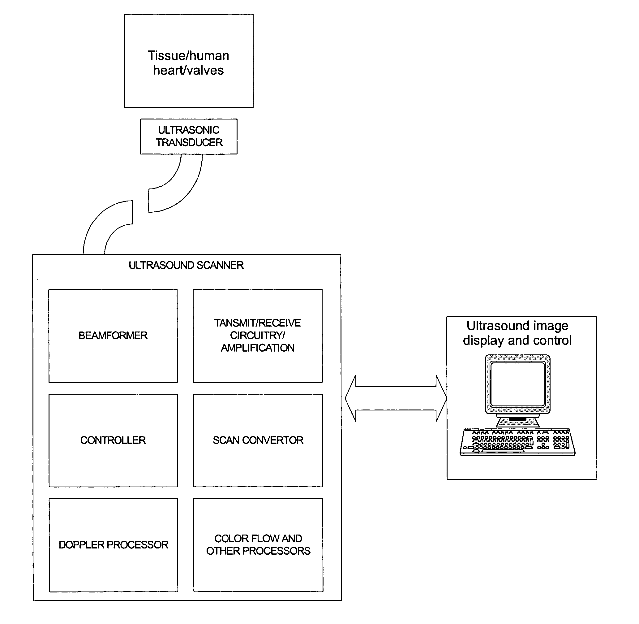 Method and system for using ultrasound in cardiac diagnosis and therapy