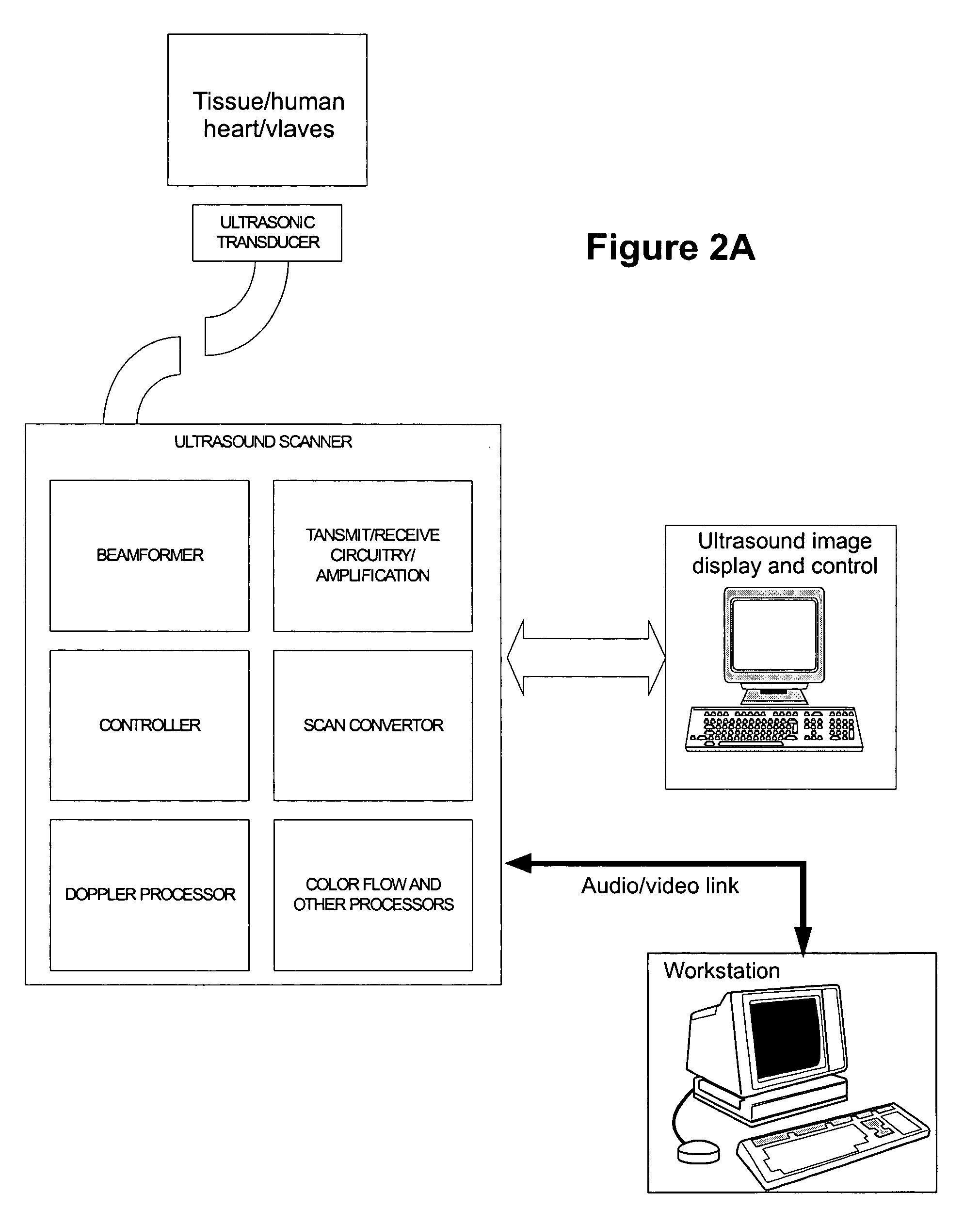 Method and system for using ultrasound in cardiac diagnosis and therapy