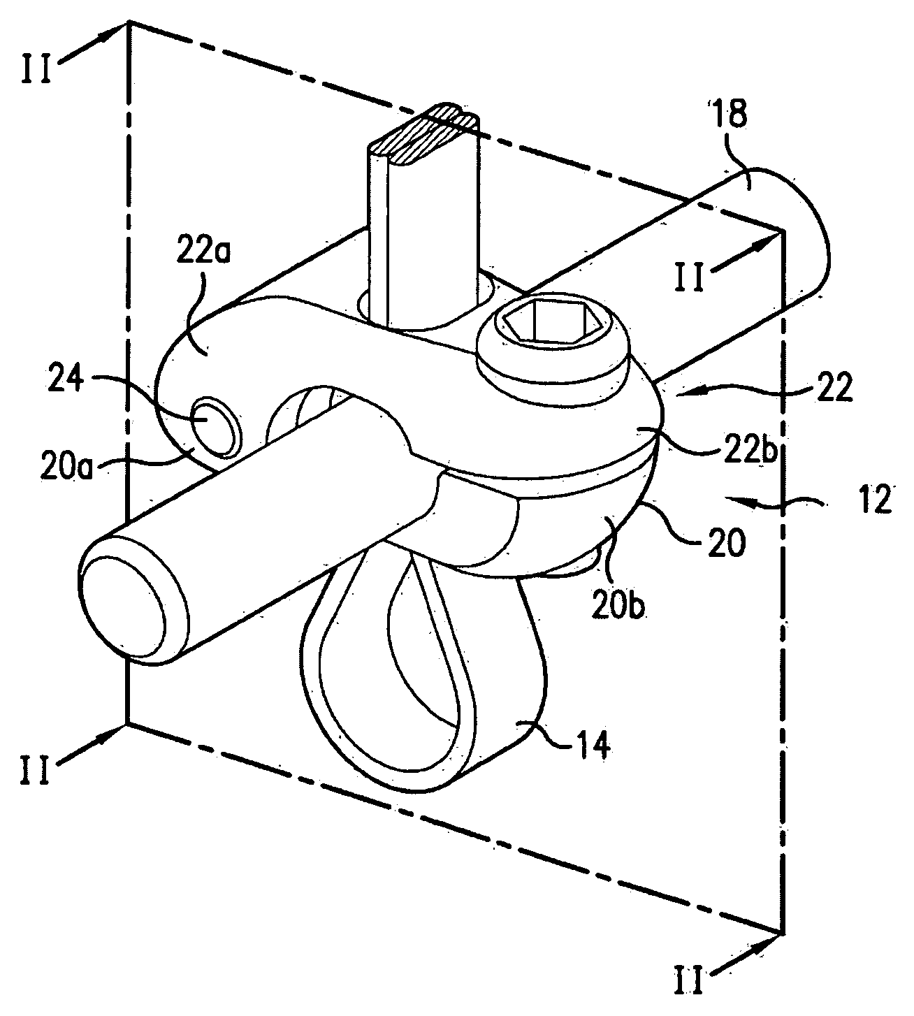 Bone fixation tensioning tool and method