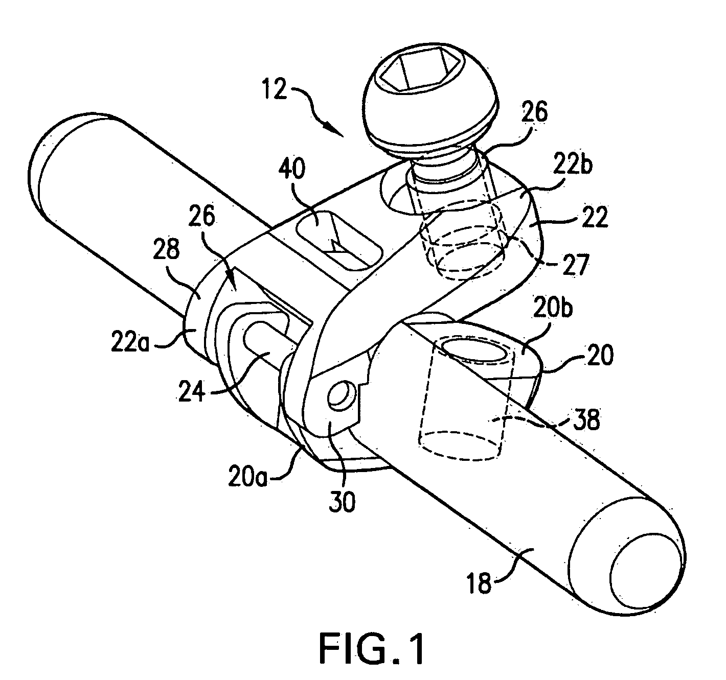 Bone fixation tensioning tool and method