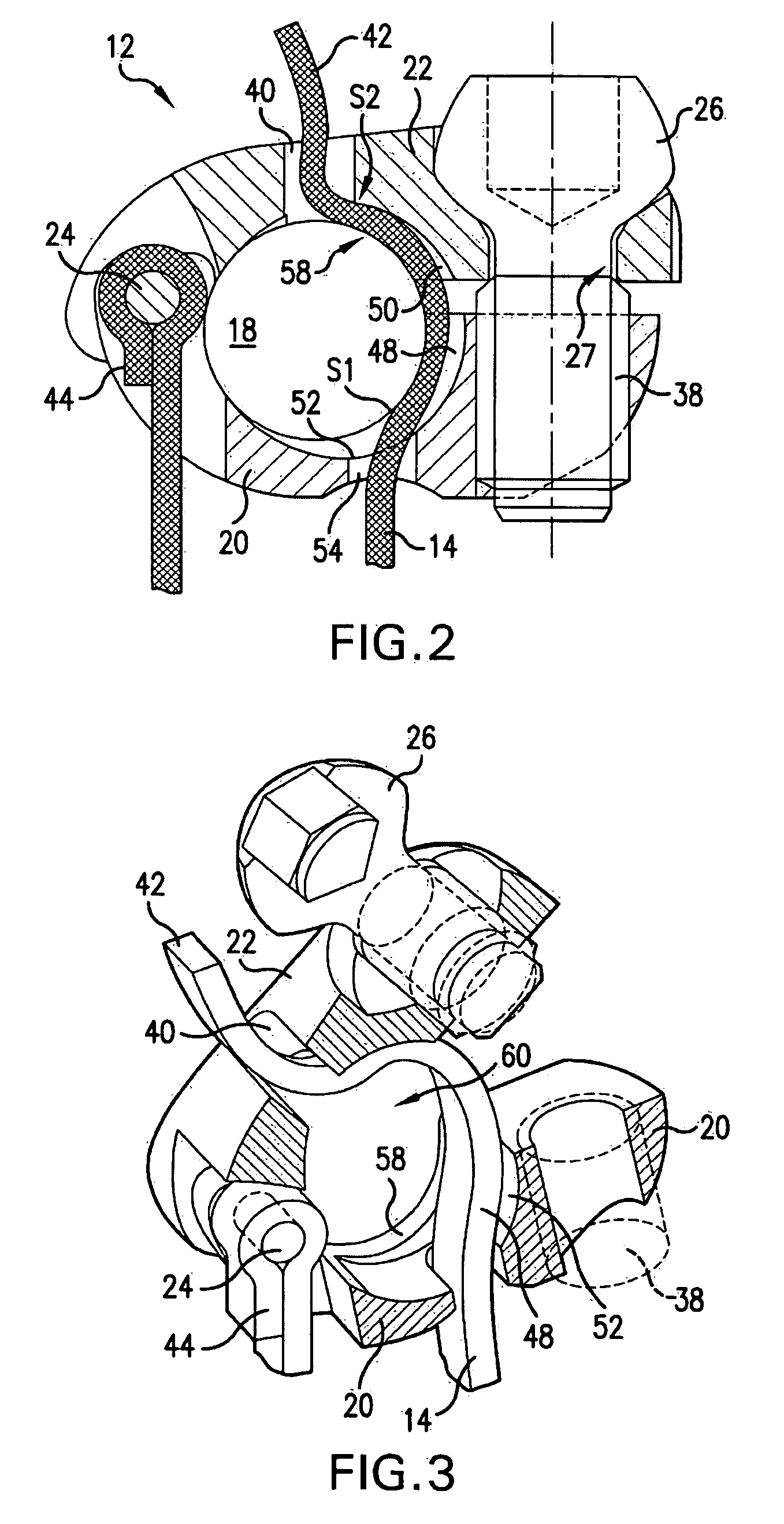 Bone fixation tensioning tool and method