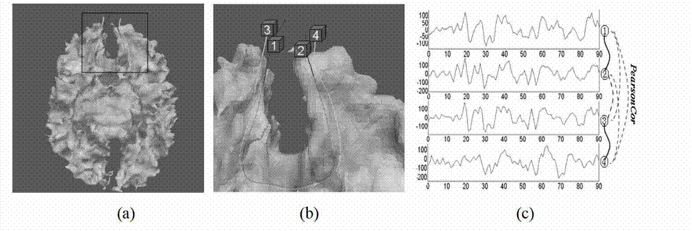 Diffusion tensor imaging white matter fiber clustering method