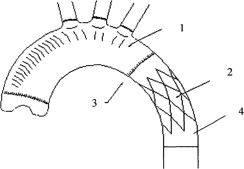 Improved intraoperation stent system