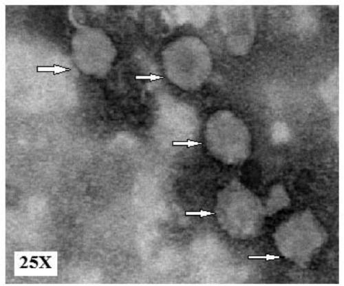 Anti-porcine epidemic diarrhea virus monoclonal antibody and its cell line and application