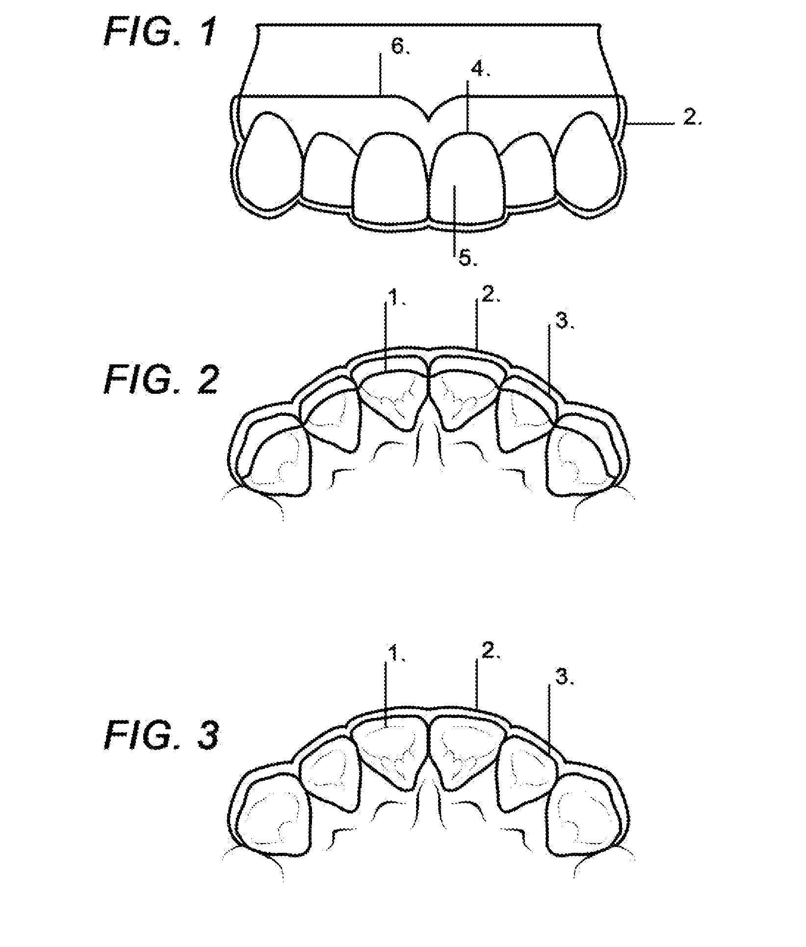 Labial Connector