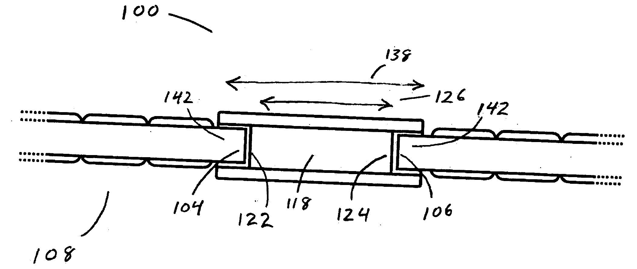 Ionically conductive neural bridge