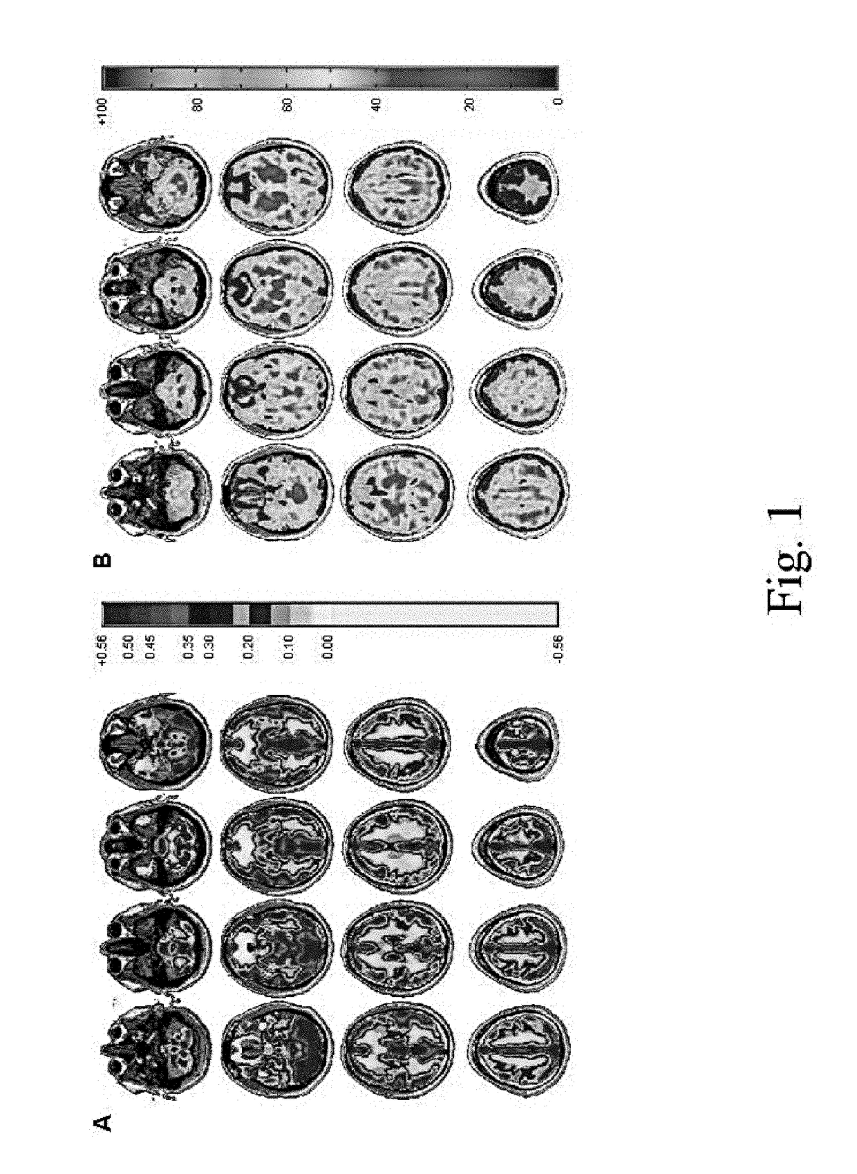 Imaging abnormalities in vascular response