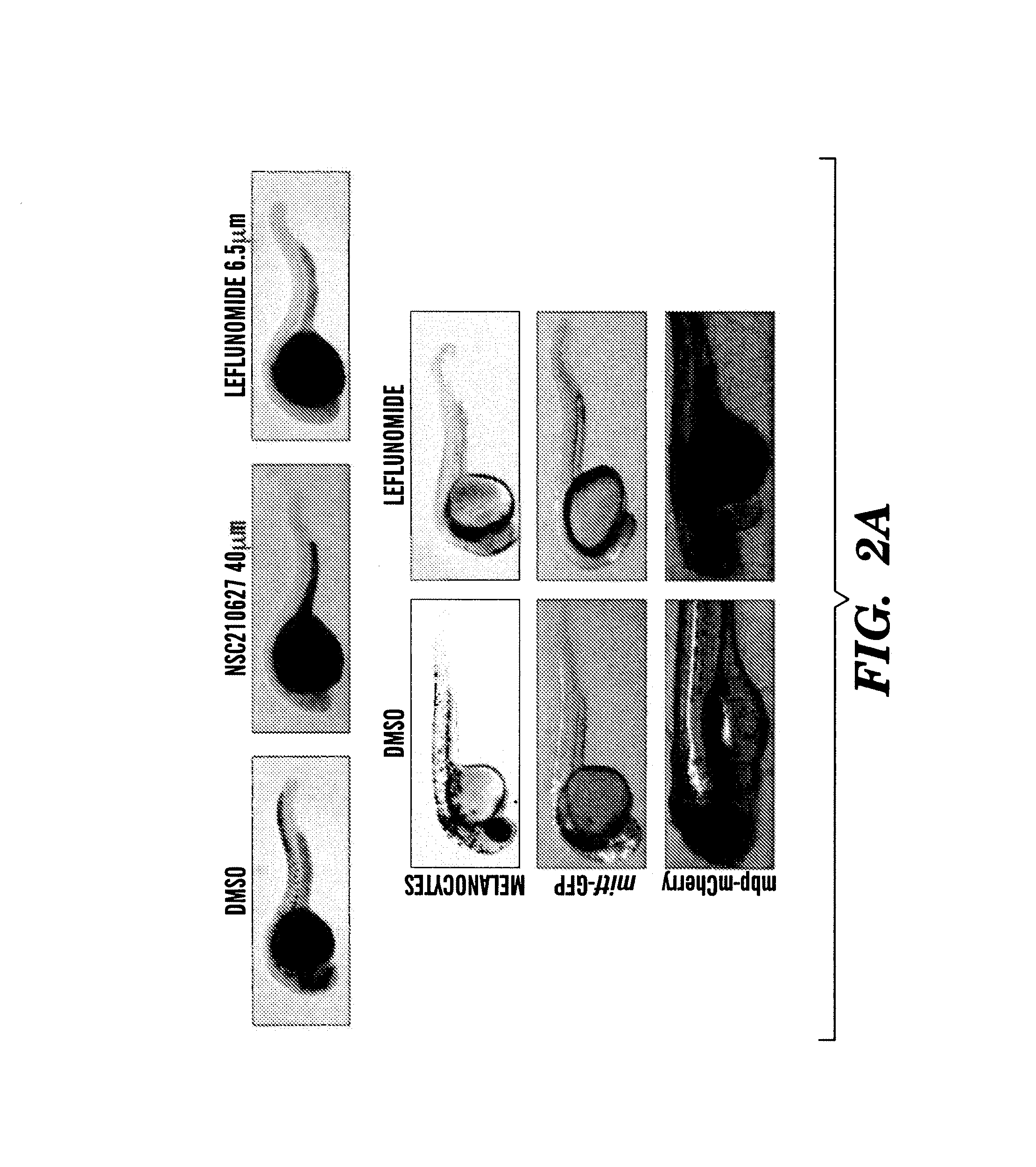 Methods for treatment of melanoma