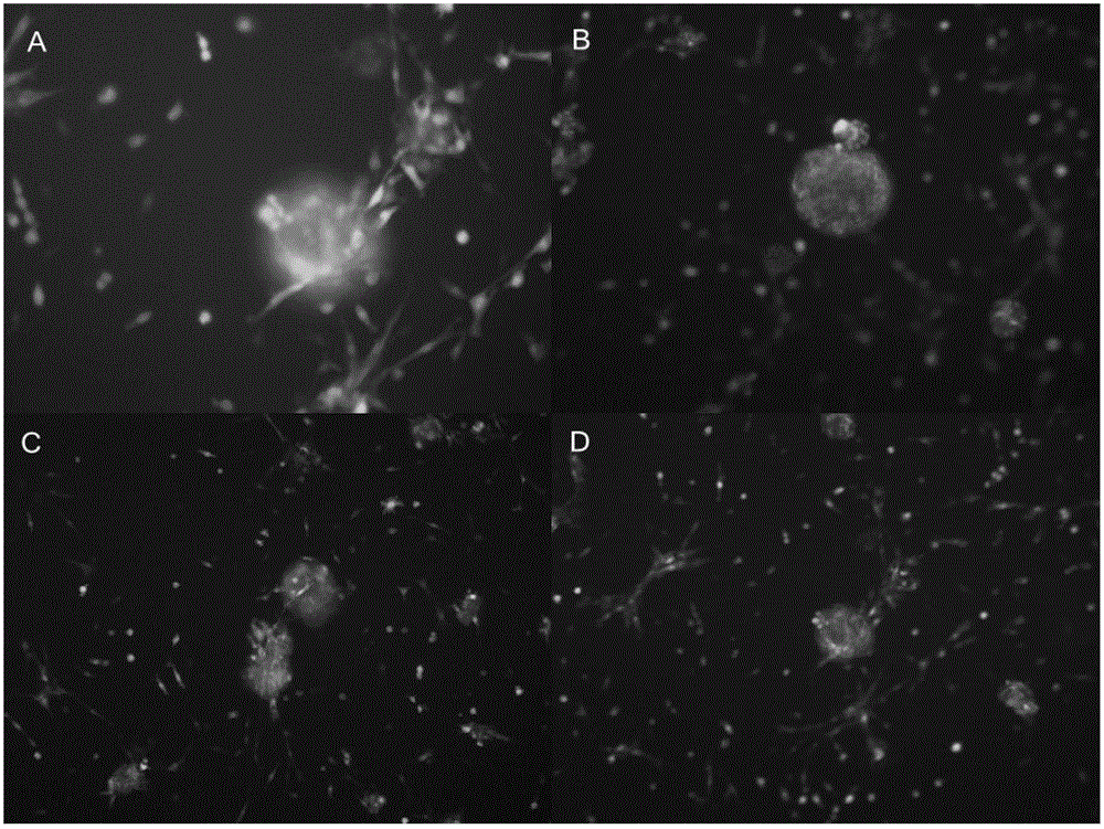 Nerve regeneration biogum and preparation method and application thereof