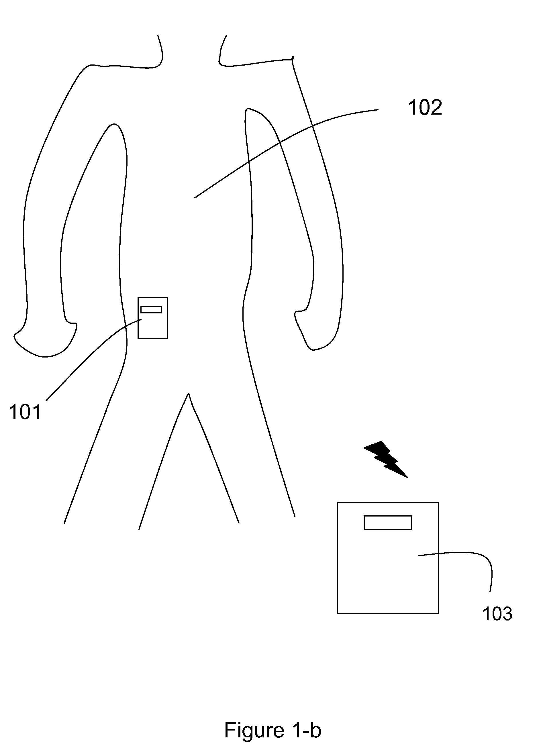 Control of Body Fluid Condition Using Diuretics, Based on Weight Measurement