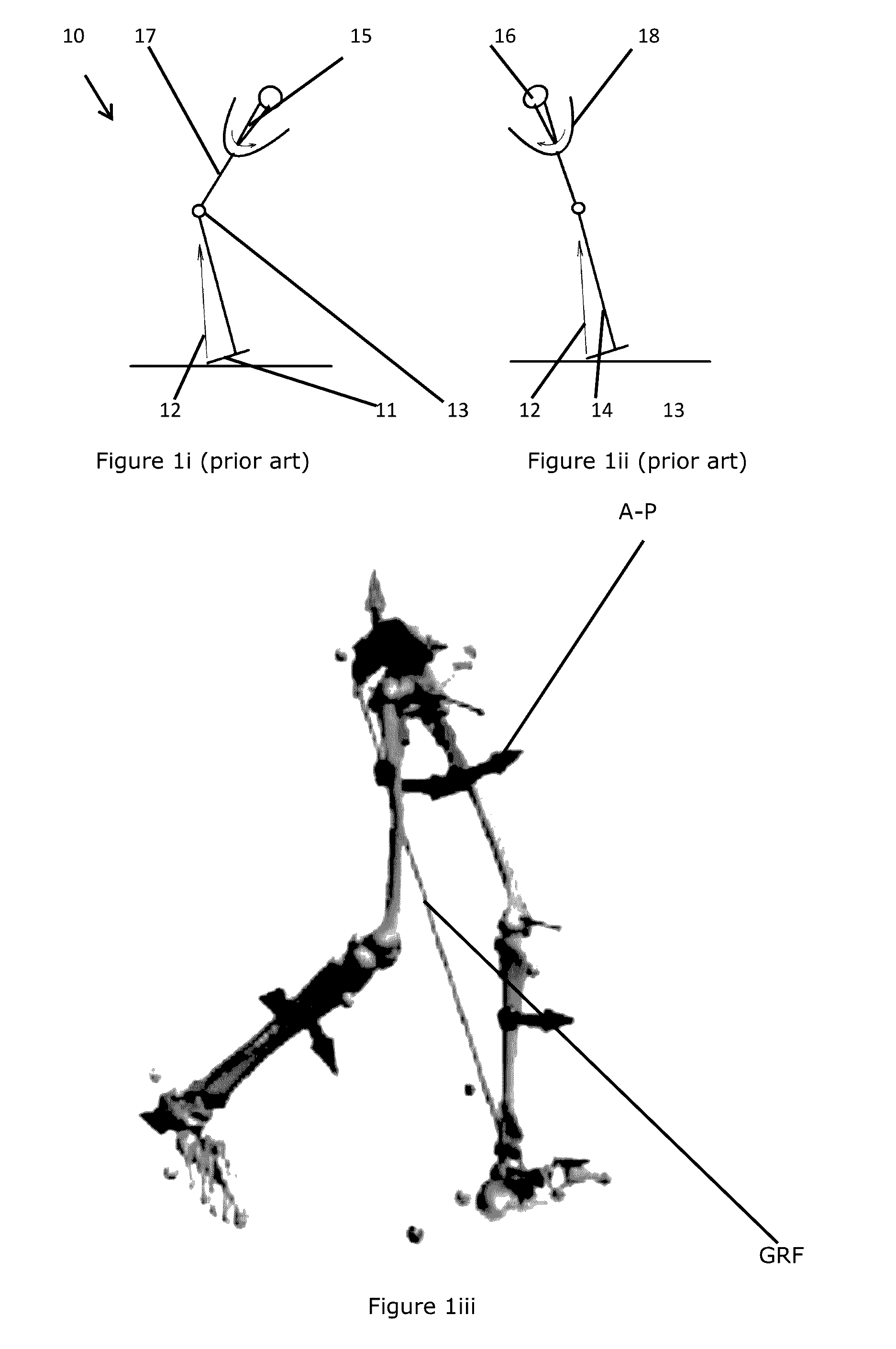 Prosthetic joints