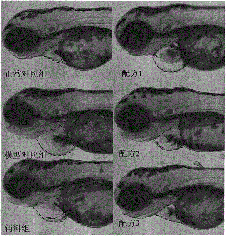 Anti-PM2.5 chewable tablets and preparing method thereof