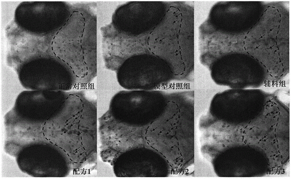 Anti-PM2.5 chewable tablets and preparing method thereof