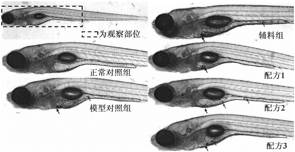 Anti-PM2.5 chewable tablets and preparing method thereof